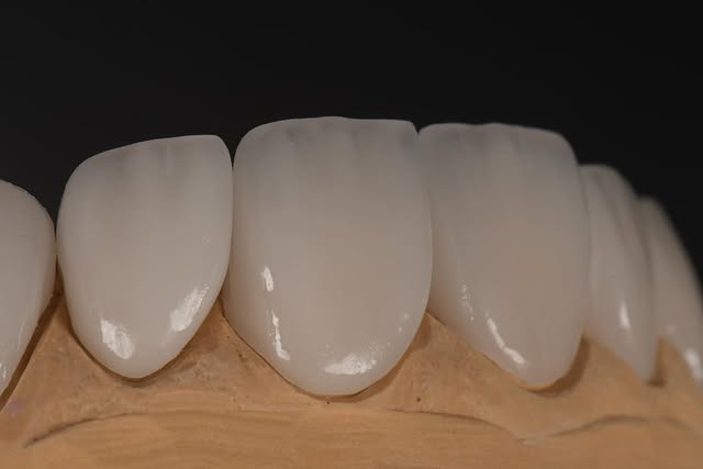 E-Max Diş Laboratuvarı