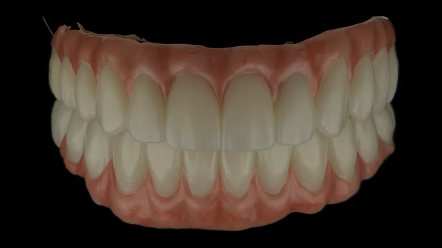 PMMA ve Geçici Restorasyonlar